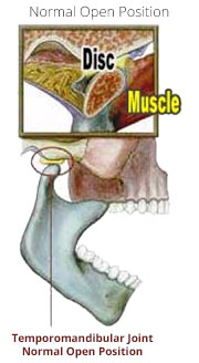 Normal open position of the jaw